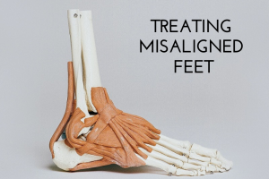 Treating Misaligned Feet